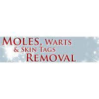 Moles Warts and Skin Tags Removal