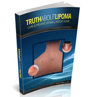 Truth About Lipoma